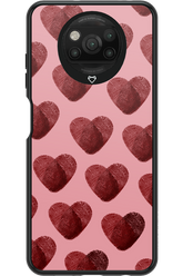 FINGERPRINTS - Xiaomi Poco X3 Pro