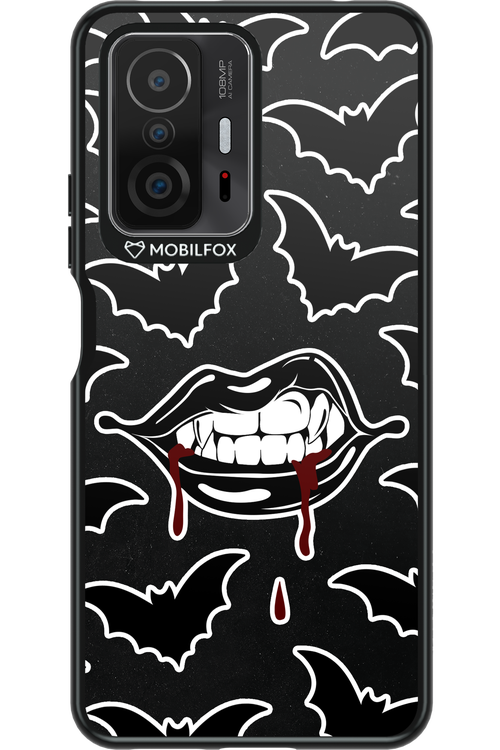 Bat Mouth - Xiaomi Mi 11T