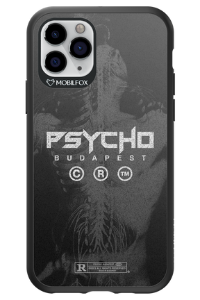 X-Ray - Apple iPhone 11 Pro