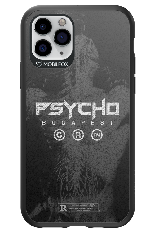 X-Ray - Apple iPhone 11 Pro