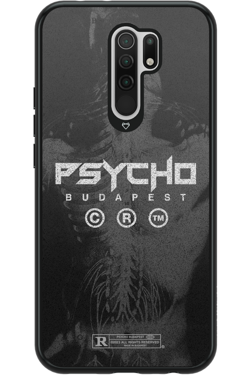 X-Ray - Xiaomi Redmi 9
