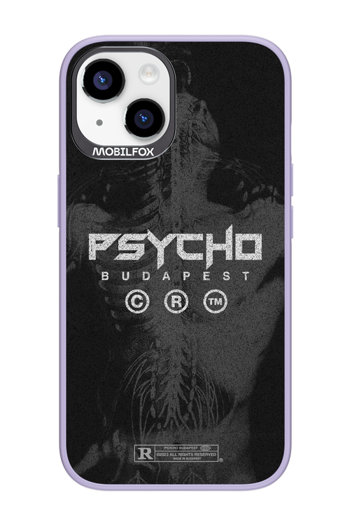 X-Ray - Apple iPhone 14