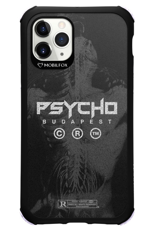 X-Ray - Apple iPhone 11 Pro