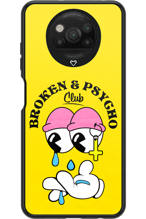 broken psycho 2.0 - Xiaomi Poco X3 NFC