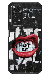 HOT AS F - Xiaomi Redmi Note 11/11S 4G