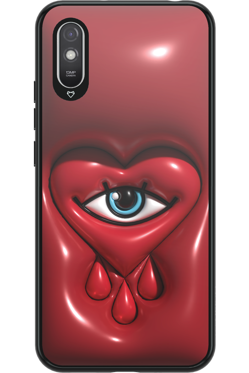 Heart Eye - Xiaomi Redmi 9A