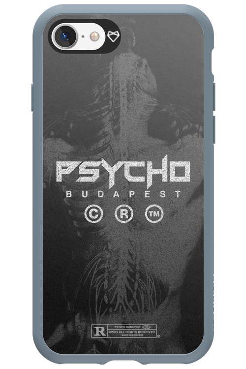 X-Ray - Apple iPhone 7