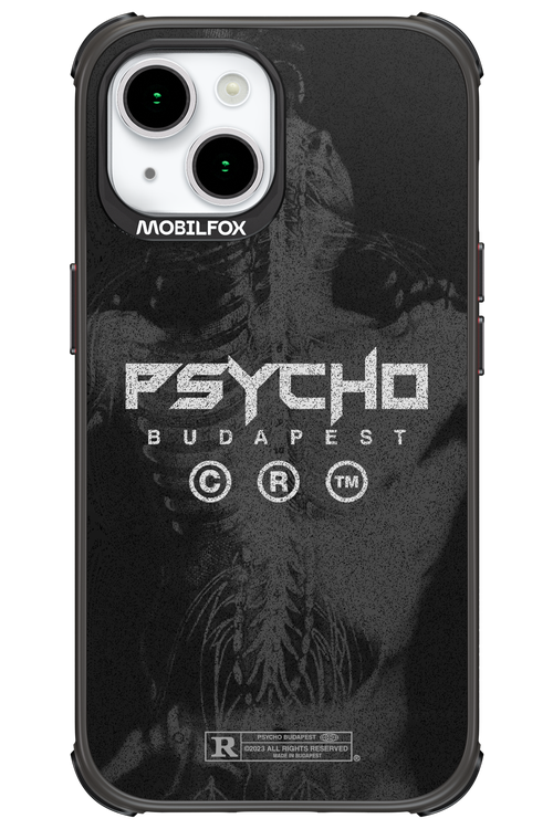 X-Ray - Apple iPhone 15
