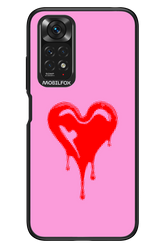 Heart Pink - Xiaomi Redmi Note 11/11S 4G