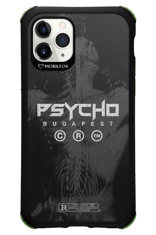 X-Ray - Apple iPhone 11 Pro