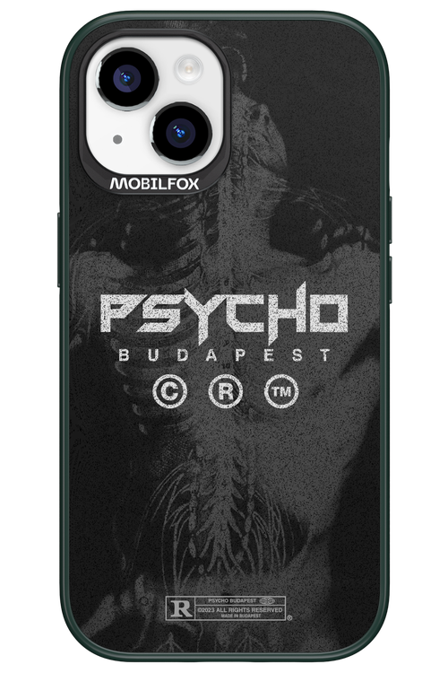 X-Ray - Apple iPhone 15
