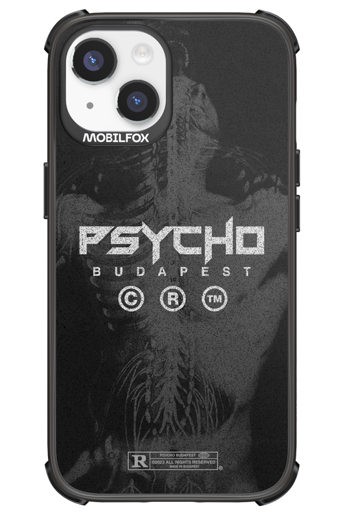 X-Ray - Apple iPhone 14