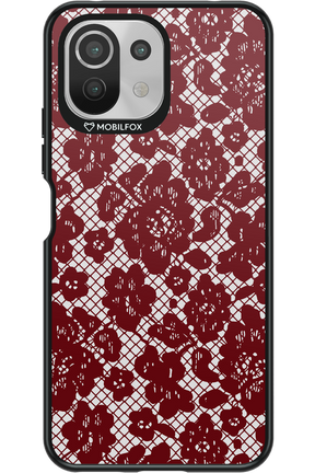 Lace Lover - Xiaomi Mi 11 Lite (2021)