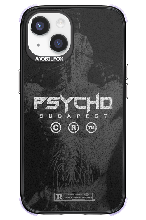 X-Ray - Apple iPhone 14