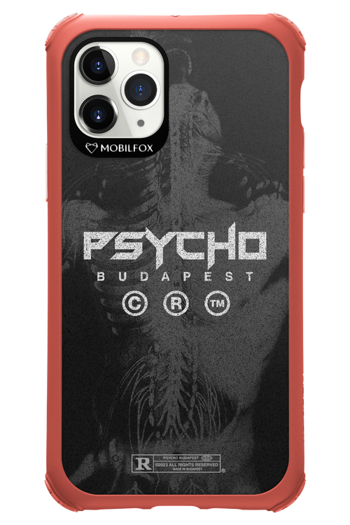 X-Ray - Apple iPhone 11 Pro