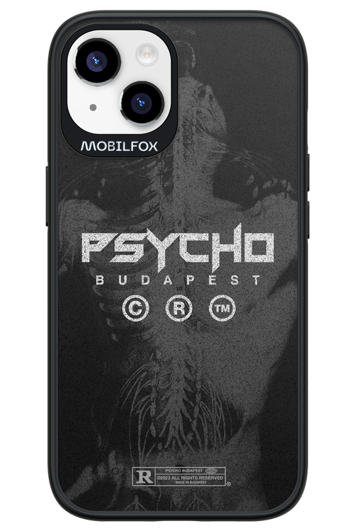 X-Ray - Apple iPhone 14