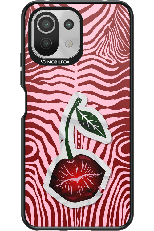 Kissy Cherry 2.0 - Xiaomi Mi 11 Lite (2021)
