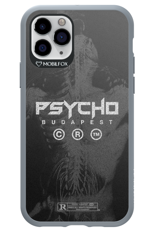 X-Ray - Apple iPhone 11 Pro