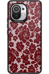 Lace Lover - Xiaomi Mi 11 5G