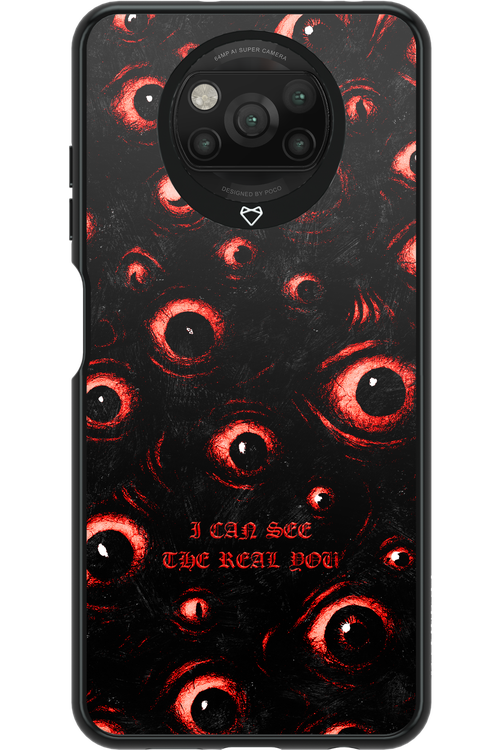 The Watchers - Xiaomi Poco X3 NFC