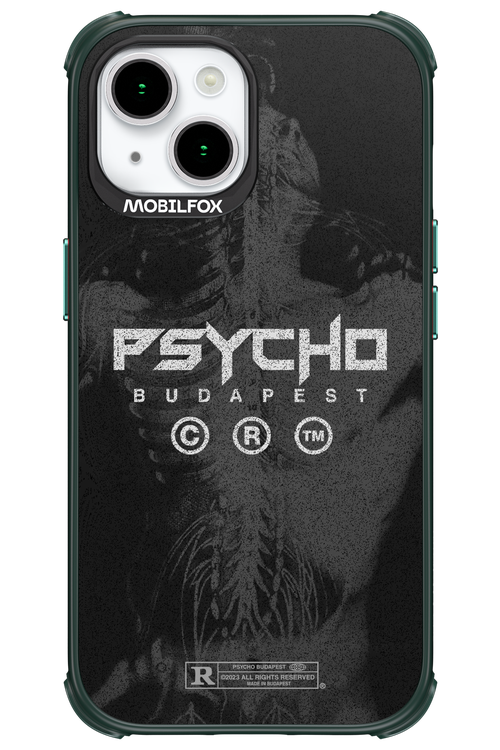 X-Ray - Apple iPhone 15