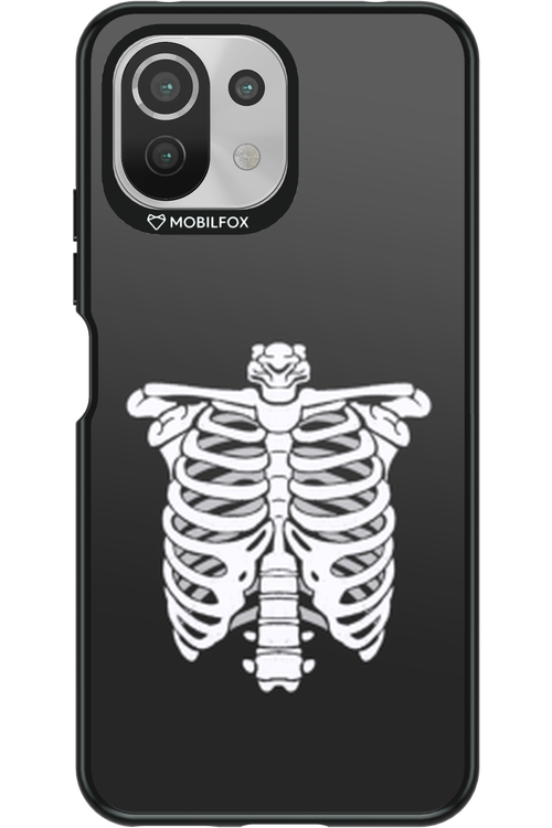 SKELETON - Xiaomi Mi 11 Lite (2021)