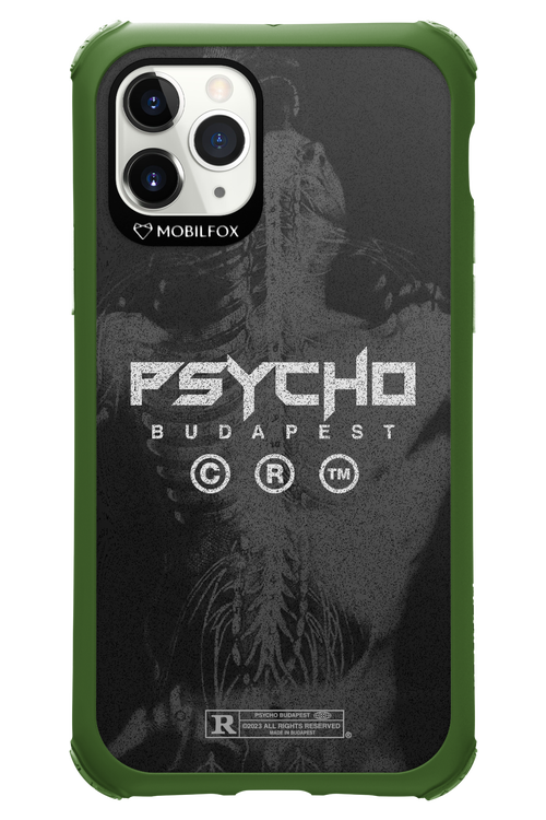 X-Ray - Apple iPhone 11 Pro