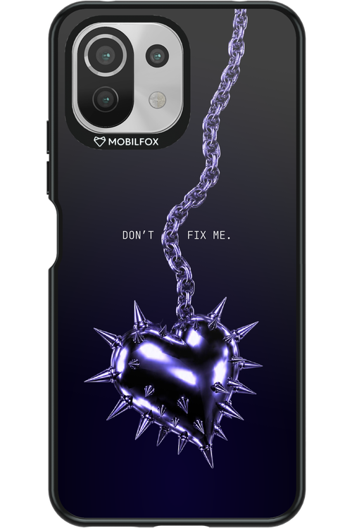 Don't fix me 2.0 - Xiaomi Mi 11 Lite (2021)