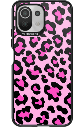 PINK LEOPARD - Xiaomi Mi 11 Lite (2021)