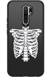 SKELETON - Xiaomi Redmi 9