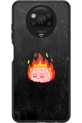 My brain - Xiaomi Poco X3 Pro