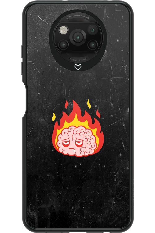 My brain - Xiaomi Poco X3 Pro