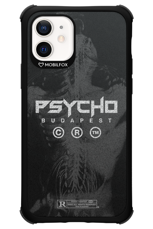 X-Ray - Apple iPhone 12