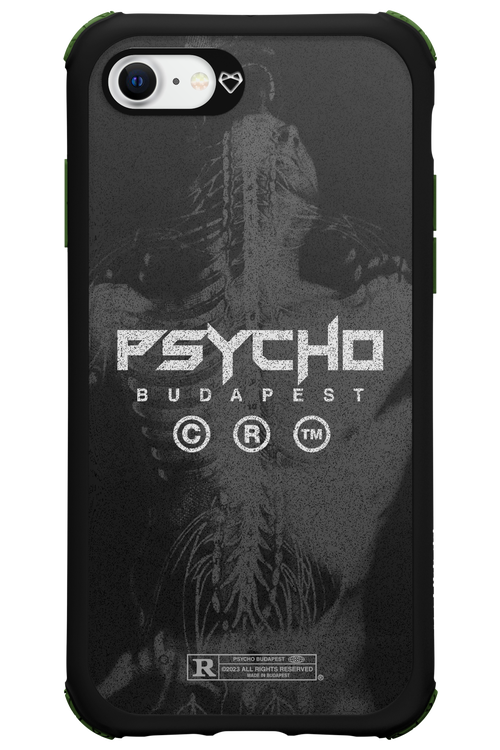X-Ray - Apple iPhone 7
