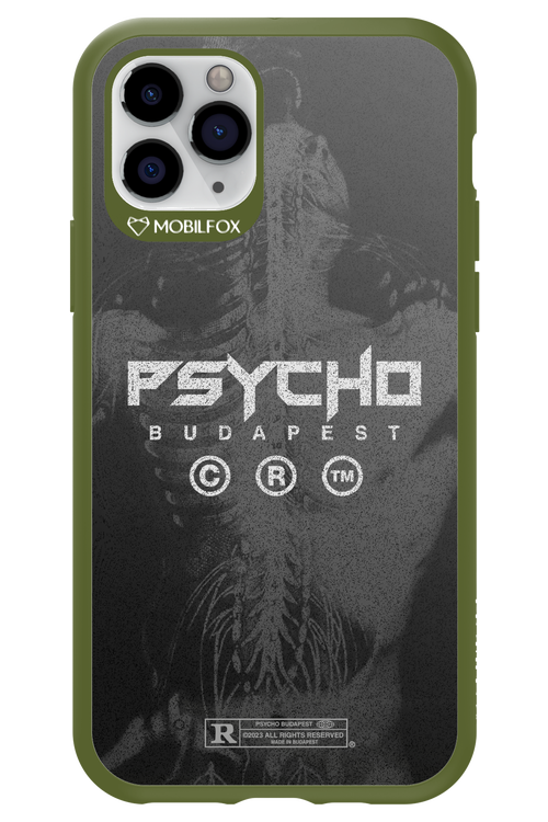 X-Ray - Apple iPhone 11 Pro