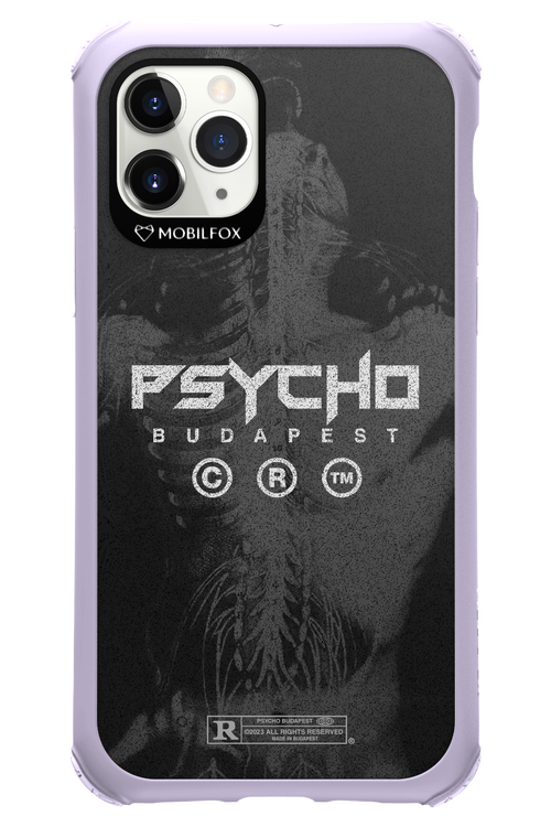 X-Ray - Apple iPhone 11 Pro