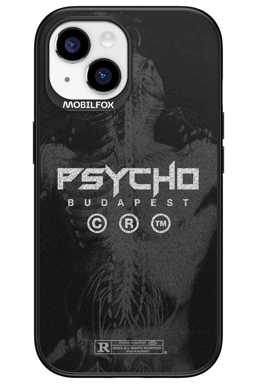 X-Ray - Apple iPhone 15