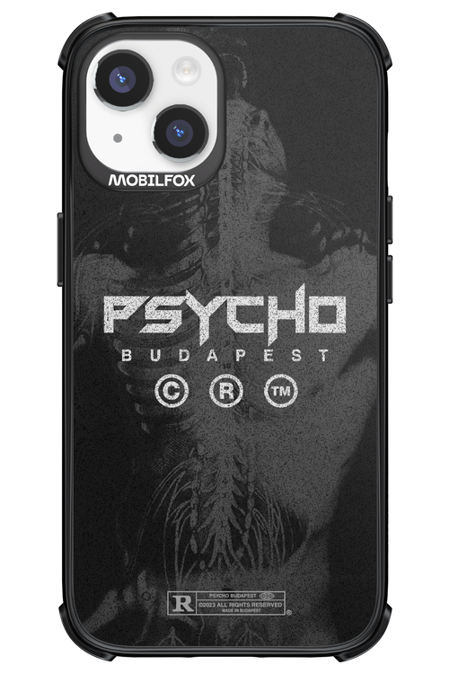 X-Ray - Apple iPhone 14