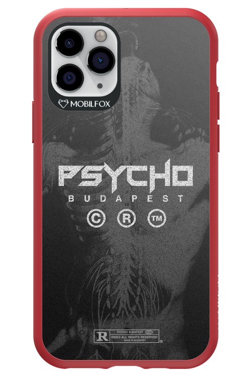 X-Ray - Apple iPhone 11 Pro