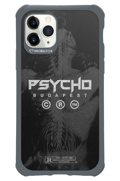 X-Ray - Apple iPhone 11 Pro