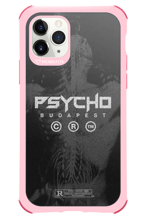 X-Ray - Apple iPhone 11 Pro