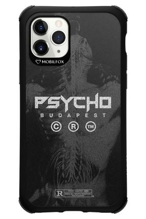 X-Ray - Apple iPhone 11 Pro