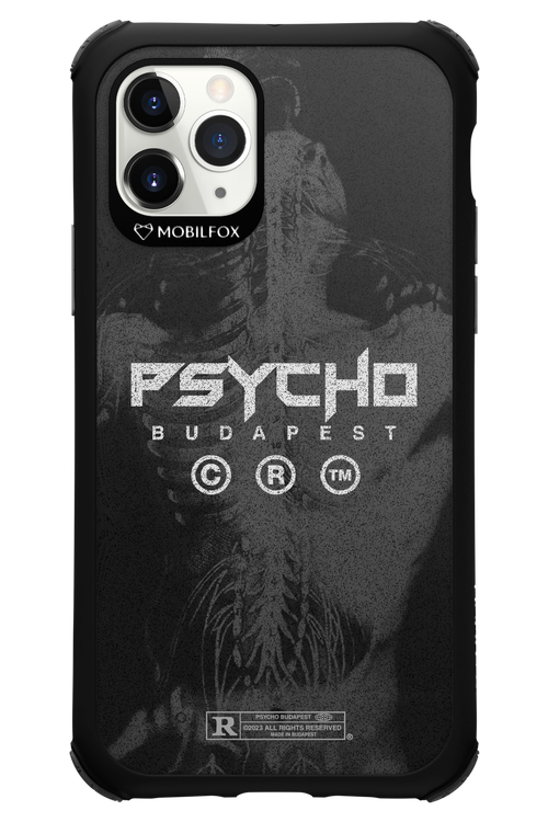 X-Ray - Apple iPhone 11 Pro