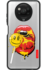 Lolli Kiss 2.0 - Xiaomi Poco X3 NFC